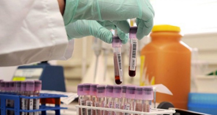 Terapia contra el cáncer en sangre logró que desaparecieran síntomas 1 1876 12a