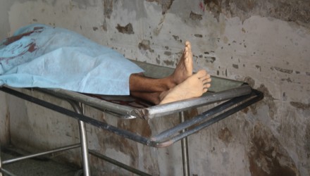 tuberculosis