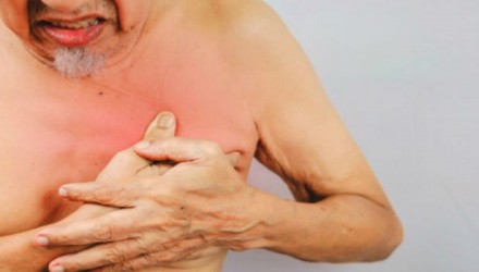 cancer de mama hombres 700x350