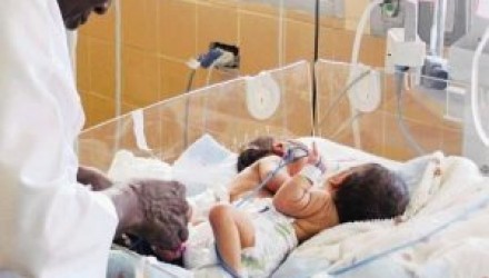 Siamesas Pertuz serán separadas a mediados de marzo en el Universitario 300x188