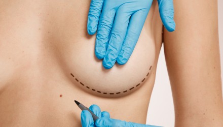 negligencia medica en reduccion de pechos.1280x960.1493558376