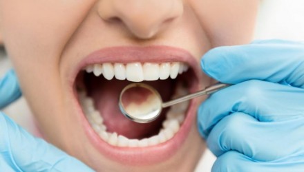 LOS DIENTES