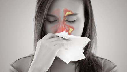 sinusitis