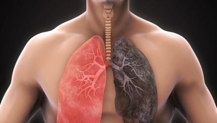 pulmones sanos