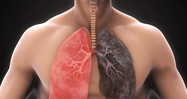 pulmones sanos