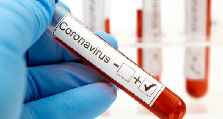 Contagios de Covid-19 en el mundo supera los 114 millones 1 Covid