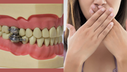 DentalSlim Diet Control