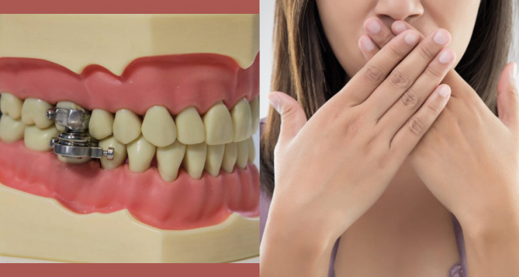 DentalSlim Diet Control