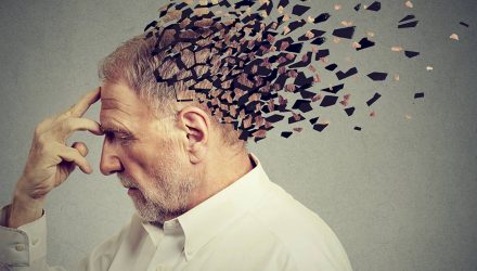 alzheimer