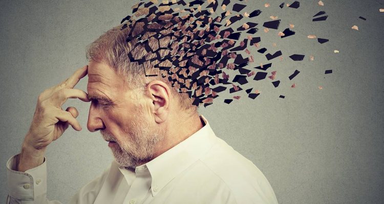alzheimer