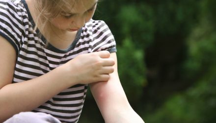 mosquitos