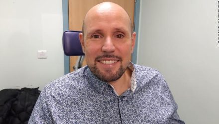 ojo impreso en 3D