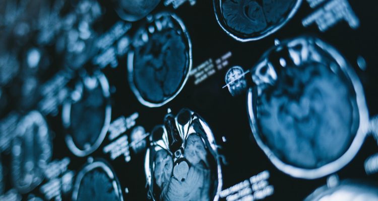 ¿Por qué la vida pasa frente a los ojos cuando estamos a punto de morir?: científicos descubrieron una posible respuesta 1 6215201f59bf5b1aea71f9c3