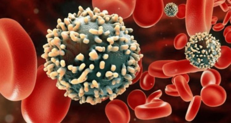 Descubrieron nueva variante más virulenta y transmisible del VIH 1 VIH