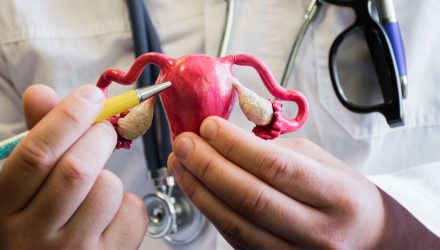 endometriosis