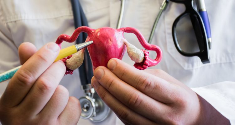 endometriosis