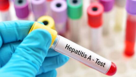 hepatitis