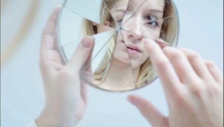 Prosopagnosia