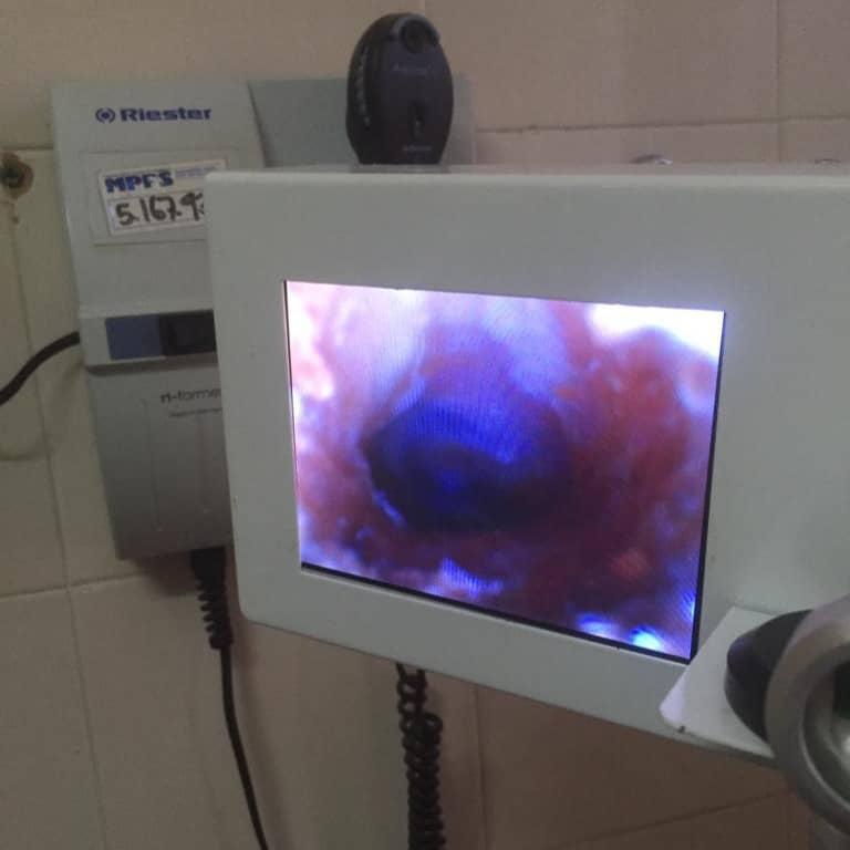 Servicio de Otorrinolaringología del SAHUM atiende a 600 pacientes por semana 4 WhatsApp Image 2022 08 22 at 1.32.42 PM