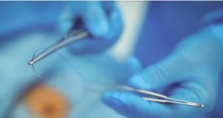 Ingenieros del MIT diseñaron suturas capaces de liberar fármacos o detectar inflamaciones 1 Sutura