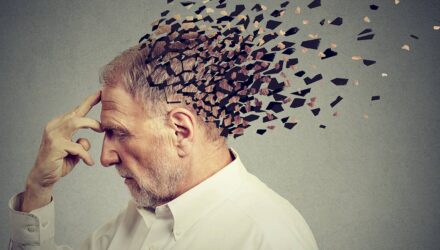 alzheimer