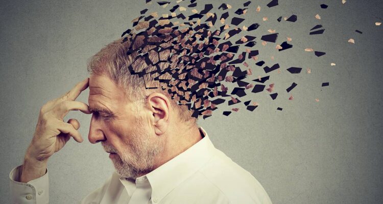 alzheimer