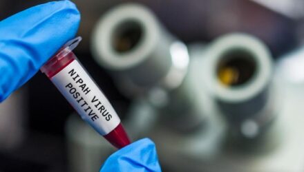 Nipah Virus