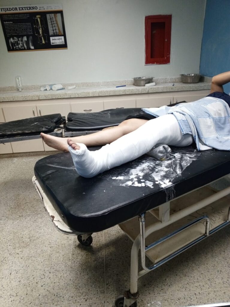 Una mujer fue arrollada por un motorizado de la Guardia Nacional en la Limpia 3 WhatsApp Image 2023 10 19 at 2.56.55 PM