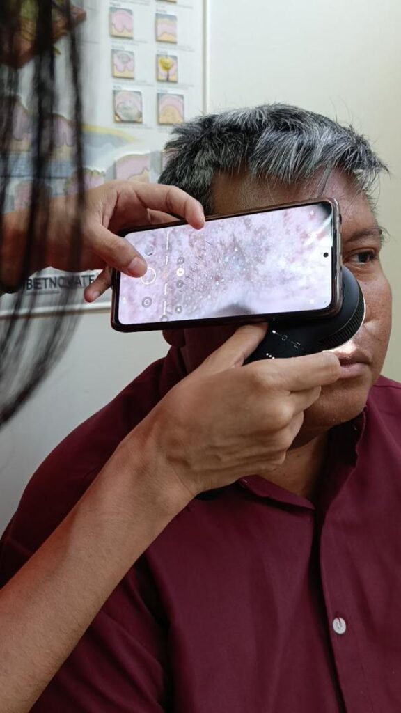 SAHUM: Enfermedades de la piel que detona el calor 5 WhatsApp Image 2024 08 20 at 5.02.20 PM