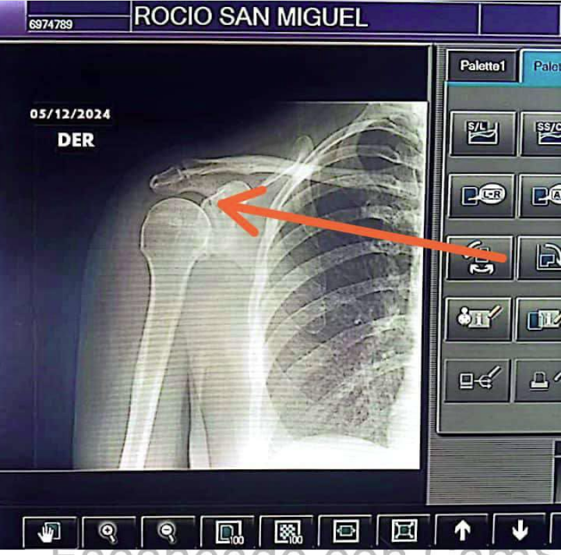 Examenes de Rocio San Migue