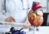 cardiovasculares