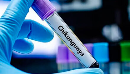 Chikungunya