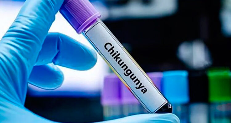 Chikungunya