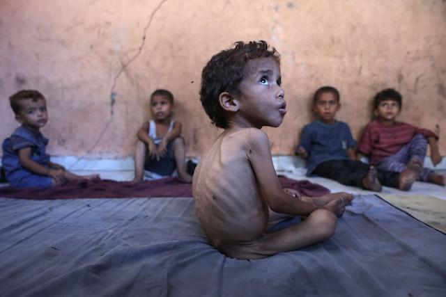 La ONU declaró oficialmente la situación de hambruna en Gaza 2 Hambruna en Gaza