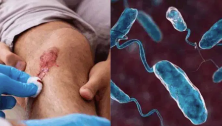 Bacteria