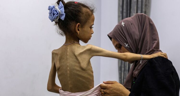 La ONU declaró oficialmente la situación de hambruna en Gaza 1 Gaza