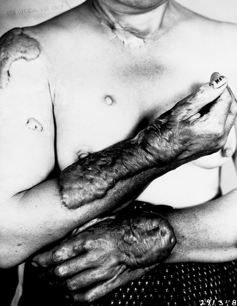 A 80 años del bombardeo atómico de EE. UU. a Japón y el mundo no aprendió la horrorosa la lección 7 outcome photo 1