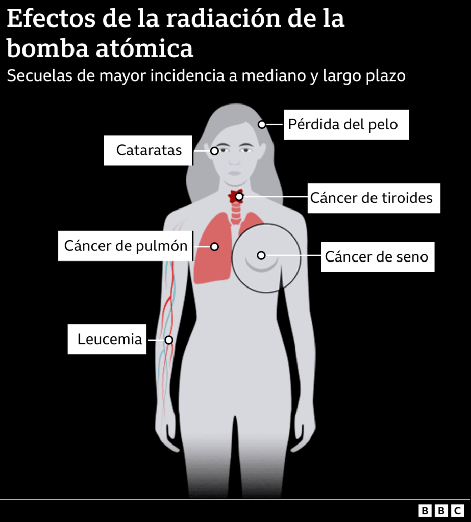 A 80 años del bombardeo atómico de EE. UU. a Japón y el mundo no aprendió la horrorosa la lección 8 outcome radiation effects body infographic 2025 es