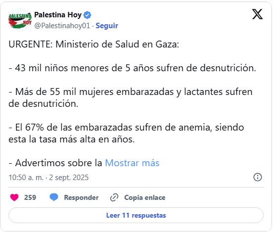Gaza: Hambruna deja más de 180 fallecidos y miles de desnutridos 2 Gaza