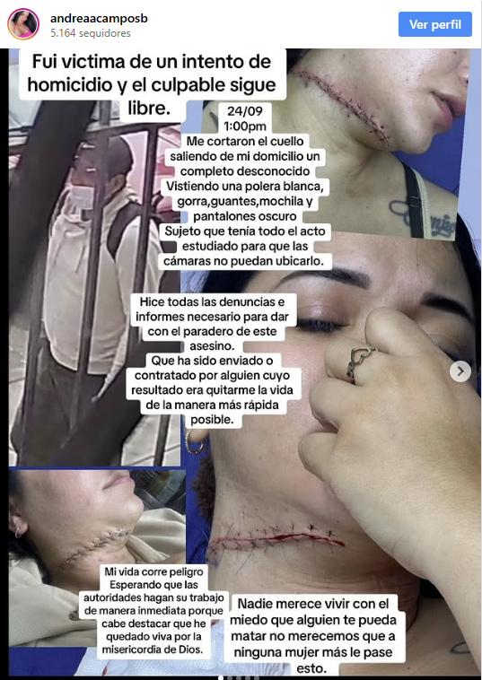 Venezolana denunció que intentaron degollarla en Perú mientras recogía a su hijo en el colegio 2 Venezola casi degollada