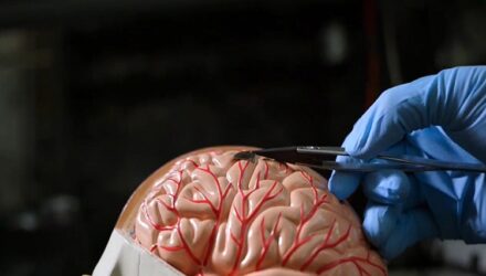 Chip cerebral
