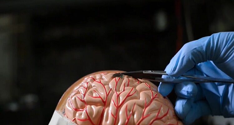 Crean chip cerebral que conecta cerebro a ordenador por WiFi 1 Chip cerebral