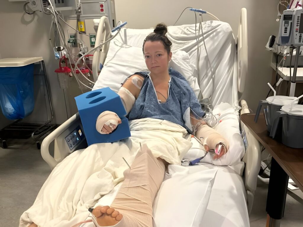Mujer de Tennessee perdió una pierna tras brutal ataque de su pitbull dentro de su casa 2 mujer pierde pierna ataque pitbull