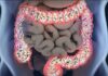 Microbiota