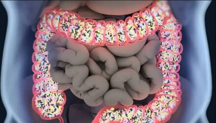 Microbiota
