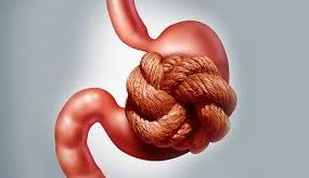 Mitos y verdades sobre la frecuencia de la evacuación intestinal. 3 La gastroenteróloga Xiao Jing Iris Wang aclara que la regularidad y la hidratación son claves para el bienestar digestivo