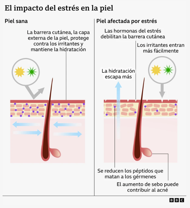 Estres