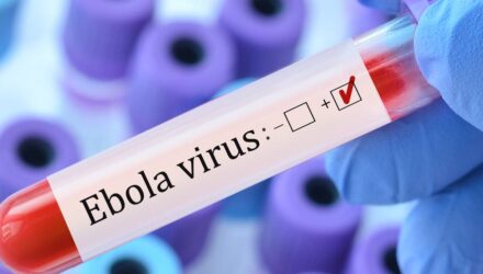 RD Congo confirmó 344 contagios y 60 muertes por ébola 2 Ebola