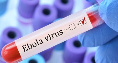 Ebola
