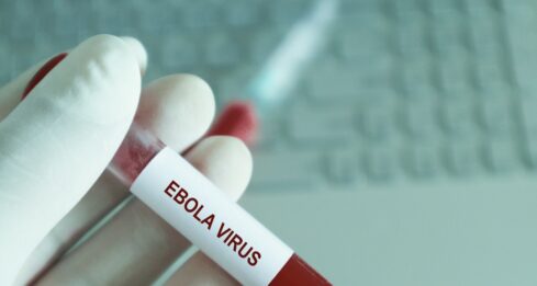 Ebola